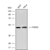 Solarbio K009869P Anti-FARS2 Polyclonal Antibody
