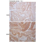 Solarbio K110323P Anti-TACR2 Polyclonal Antibody