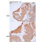 Solarbio K112196P Anti-NACAD Polyclonal Antibody