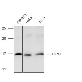 Solarbio K112236P Anti-TSPO Polyclonal Antibody