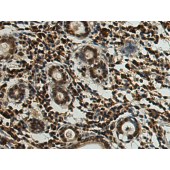 Solarbio K009868P Anti-HEXIM2 Polyclonal Antibody