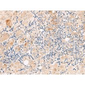 Solarbio K009847P Anti-THNSL1 Polyclonal Antibody