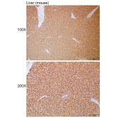 Solarbio K112268P Anti-SERPINA10 Polyclonal Antibody