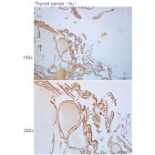 Solarbio K112295P Anti-SYT11 Polyclonal Antibody