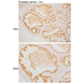 Solarbio K110049P Anti-HDAC6 Polyclonal Antibody