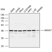 Solarbio K110100P Anti-ANXA7 Polyclonal Antibody