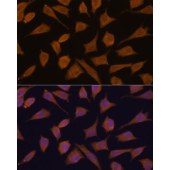 Solarbio K009771P Anti-SEPT3 Polyclonal Antibody