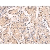 Solarbio K009876P Anti-PLLP Polyclonal Antibody