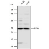 Solarbio K110296P Anti-RPA4 Polyclonal Antibody