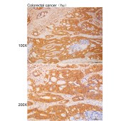 Solarbio K112192P Anti-ROCK1 Polyclonal Antibody