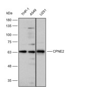 Solarbio K112275P Anti-CPNE2 Polyclonal Antibody
