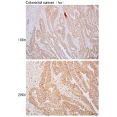 Solarbio K110484P Anti-VPS35 Polyclonal Antibody