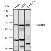 Solarbio K110493P Anti-TBC1D5 Polyclonal Antibody