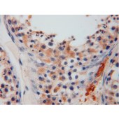 Solarbio K009777P Anti-GSTM3 Polyclonal Antibody