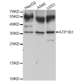 Solarbio K004215P Anti-ATP1B1 Polyclonal Antibody
