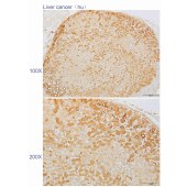 Solarbio K110284P Anti-CLTC Polyclonal Antibody