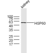 Solarbio K009460P Anti-HSPD1 Polyclonal Antibody