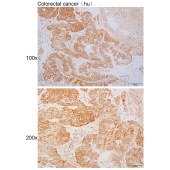 Solarbio K110405P Anti-GDI1 Polyclonal Antibody