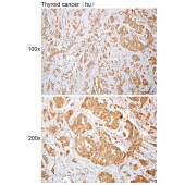 Solarbio K112413P Anti-UBQLN4 Polyclonal Antibody