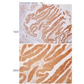 Solarbio K110356P Anti-RPL10L Polyclonal Antibody