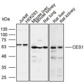 Solarbio K110052P Anti-CES1 Polyclonal Antibody