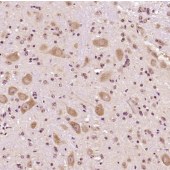 Solarbio K009636P Anti-TUBB3 Polyclonal Antibody
