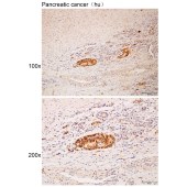 Solarbio K112181P Anti-RAB3GAP2 Polyclonal Antibody