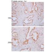 Solarbio K110114P Anti-JOSD1 Polyclonal Antibody