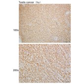 Solarbio K110066P Anti-RHOT2 Polyclonal Antibody