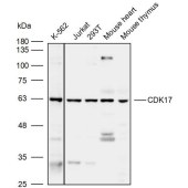 Solarbio K110093P Anti-CDK17 Polyclonal Antibody
