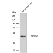 Solarbio K009853P Anti-RMDN2 Polyclonal Antibody