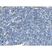 Solarbio K009822P Anti-UFC1 Polyclonal Antibody