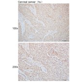 Solarbio K110058P Anti-XRN2 Polyclonal Antibody