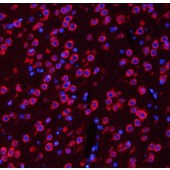 Solarbio K009636P Anti-TUBB3 Polyclonal Antibody