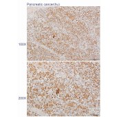 Solarbio K110492P Anti-CFAP36 Polyclonal Antibody