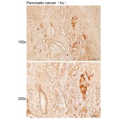 Solarbio K112166P Anti-PARD3 Polyclonal Antibody
