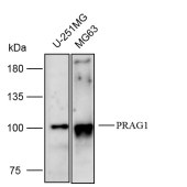 Solarbio K112164P Anti-PRAG1 Polyclonal Antibody