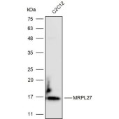 Solarbio K110403P Anti-MRPL27 Polyclonal Antibody