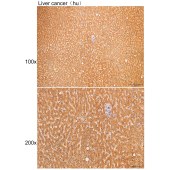 Solarbio K200079M Anti-TF Monoclonal Antibody