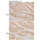 Solarbio K110063P Anti-CCDC90B Polyclonal Antibody