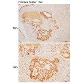 Solarbio K110486P Anti-ODF2 Polyclonal Antibody
