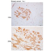 Solarbio K110456P Anti-FTO Polyclonal Antibody