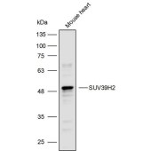 Solarbio K110018P Anti-SUV39H2 Polyclonal Antibody