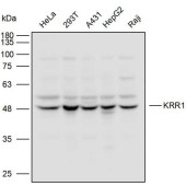 Solarbio K110507P Anti-KRR1 Polyclonal Antibody