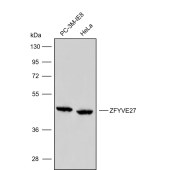Solarbio K009851P Anti-ZFYVE27 Polyclonal Antibody