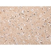 Solarbio K009880P Anti-HTRA1 Polyclonal Antibody