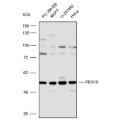 Solarbio K112303P Anti-PEG10 Polyclonal Antibody