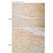 Solarbio K110500P Anti-ZBTB24 Polyclonal Antibody