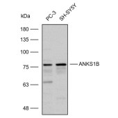Solarbio K112306P Anti-ANKS1B Polyclonal Antibody