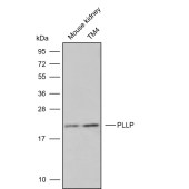 Solarbio K009876P Anti-PLLP Polyclonal Antibody